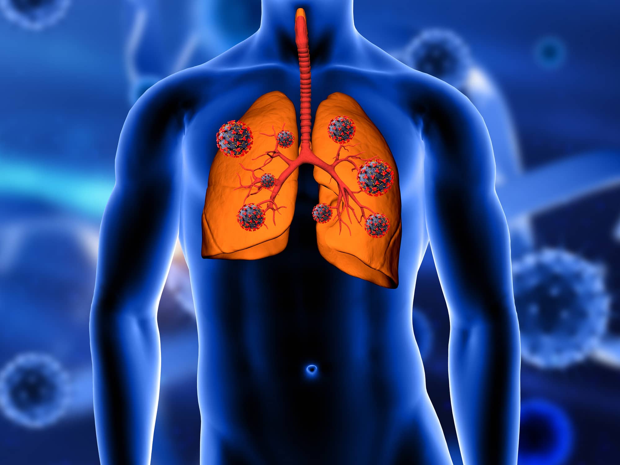 3D render of a medical background with close up of lungs being attacked by Covid 19 virus cells - role of mono virus and fat cells in long covid